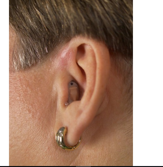 ite-hearing-aids from Century Hearing Aids