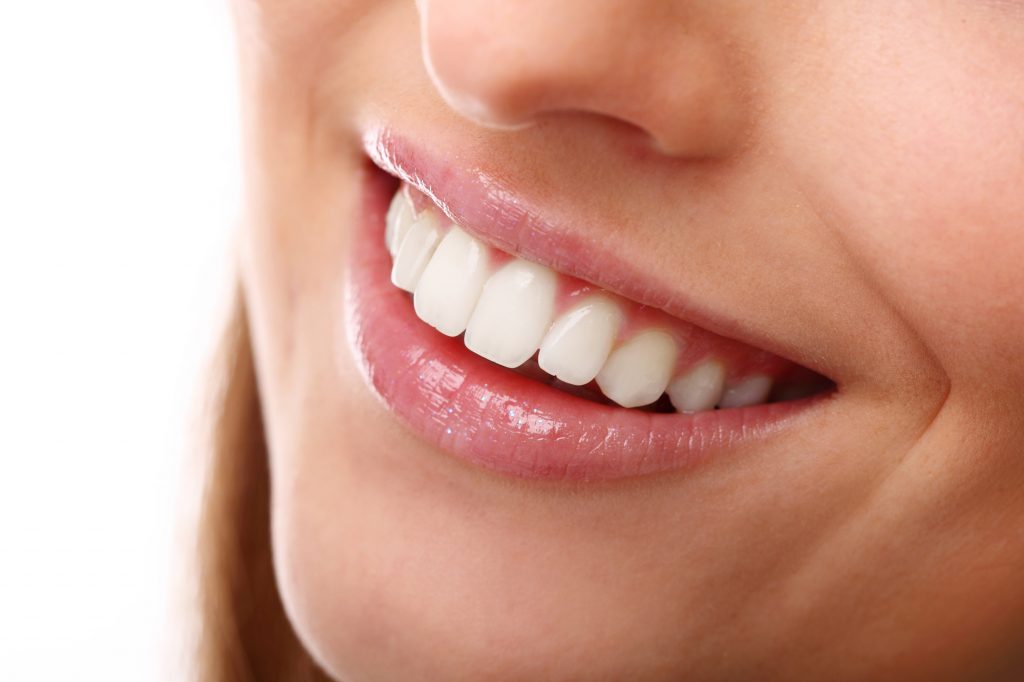 teeth whitening at home