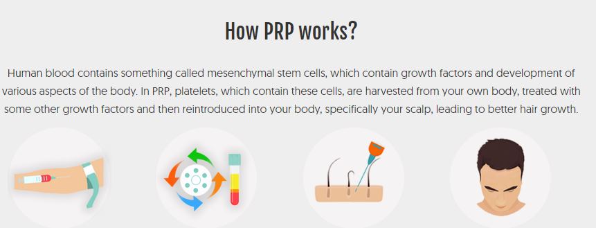 PRP Treatment for hair loss