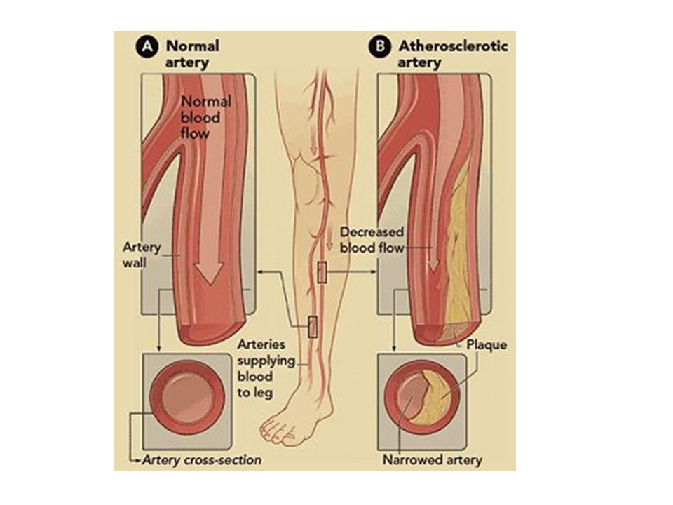 Blood Circulation