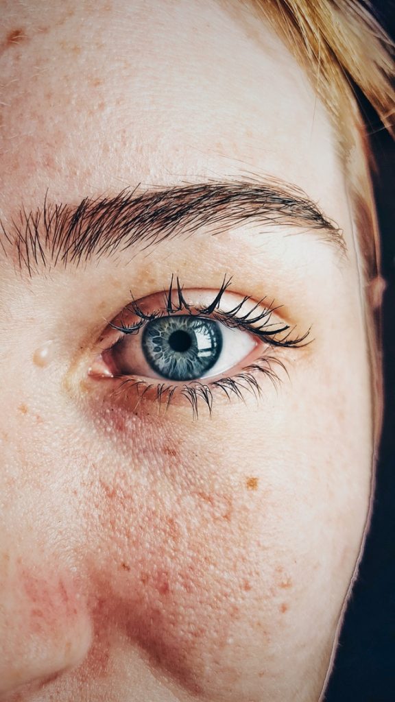 6 ways to prevent skin cancer