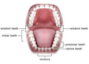 wisdom teeth removal map of teeth in mouth